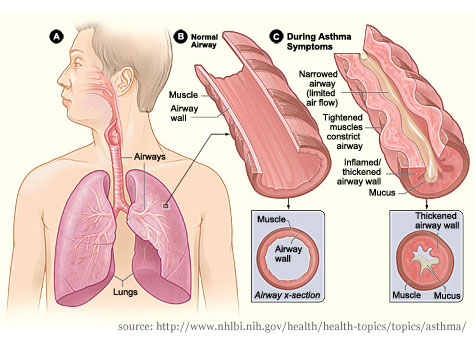 what else can cause asthma symptoms